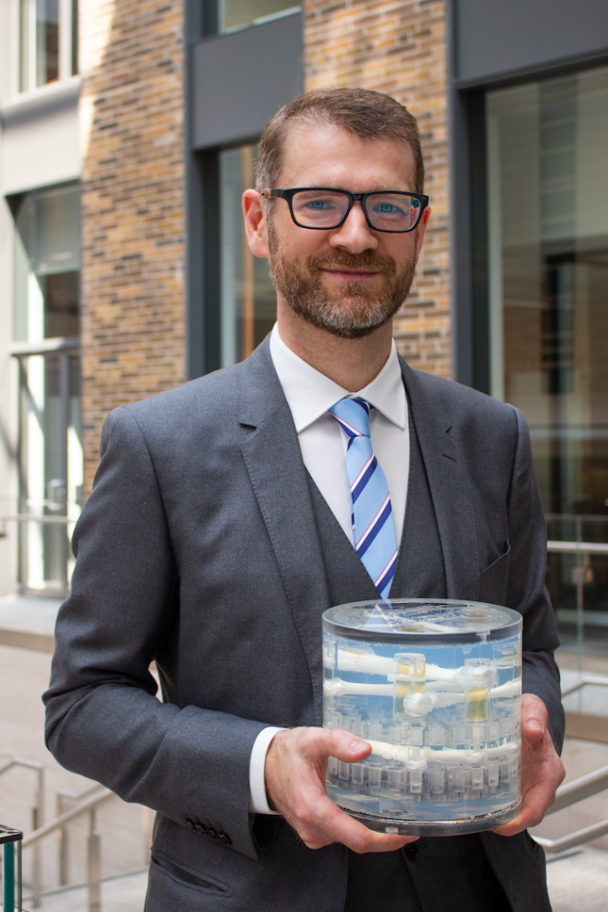 Fergal Kerins, CEO of PreOperative Performance holds the company's diffusion phantom, an MRI-compatible device made of plastic and water, in his hands in a brightly lit office space. 